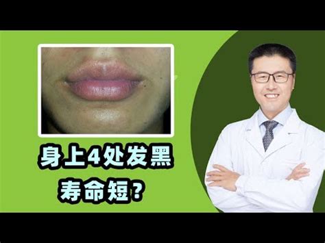 人中發黑|看臉色知身體健康！－發黑、青、紅各是什麼狀況？ 